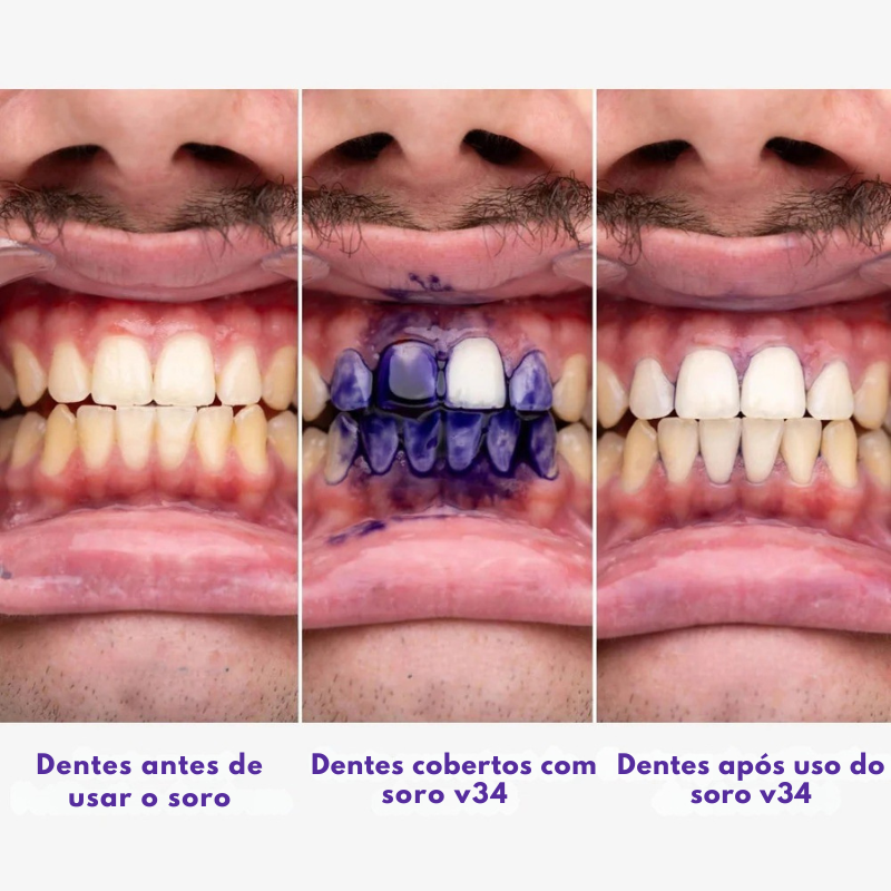 Sorria™