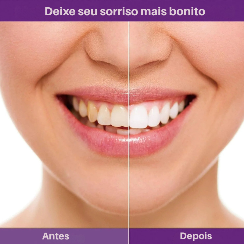 Sorria™